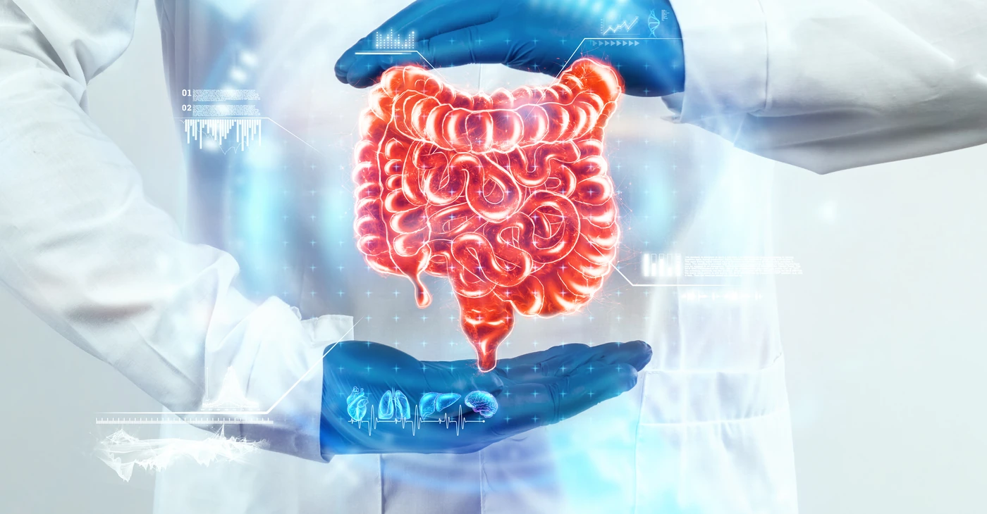 How to Treat Ulcerative Colitis