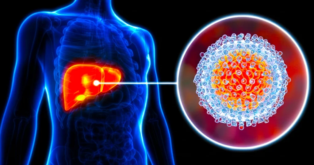 Illustration showing hepatitis C virus affecting the liver.