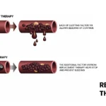 Comparison of hemophilia treatment with and without replacement therapy
