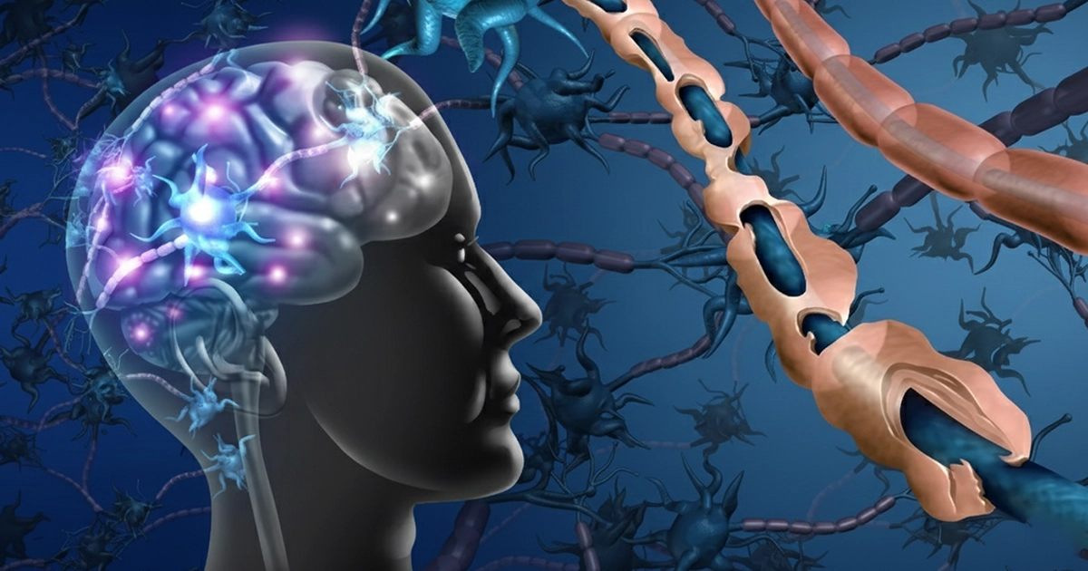 Multiple Sclerosis Medication