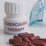 Tuberculosis therapy bottle with capsules and lung model.
