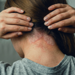 https://statspecialtyhospital.com/how-long-does-a-sore-throat-last