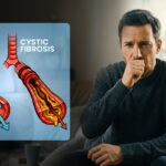 Man coughing beside diagram of Cystic Fibrosis showing healthy airway vs mucus-clogged airway