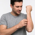 A man in a grey t-shirt looking concerned while scratching an area of red, irritated skin on his inner forearm.