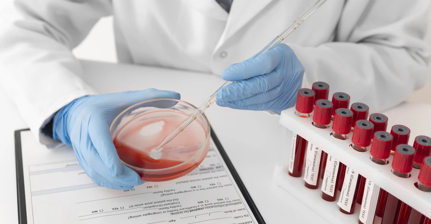 Sickle Cell Anemia – Diagnosis & Treatment
